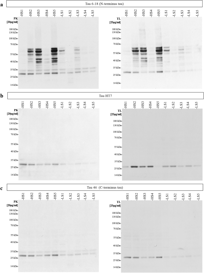 Fig. 4: Tau derived from high and low seeder PSP cases exhibits distinct protease resistance profiles.