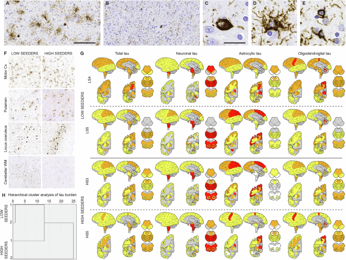 Fig. 6: Comparison and distribution of tau-immunopositive pathology across major brain regions in low and high seeders.