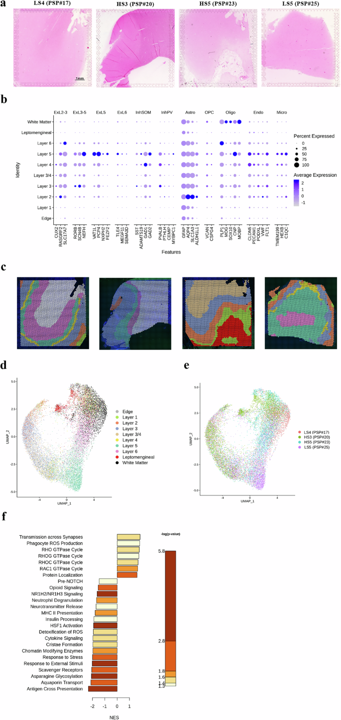 Fig. 7: Spatial transcriptomics reveals immune and neuronal dysregulation in high-seeder PSP cases.
