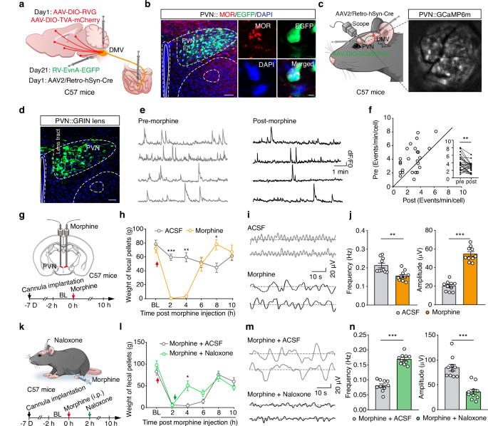 Fig. 5: Morphine reduces DMV-projecting PVNGlu neuronal activity to induce constipation.