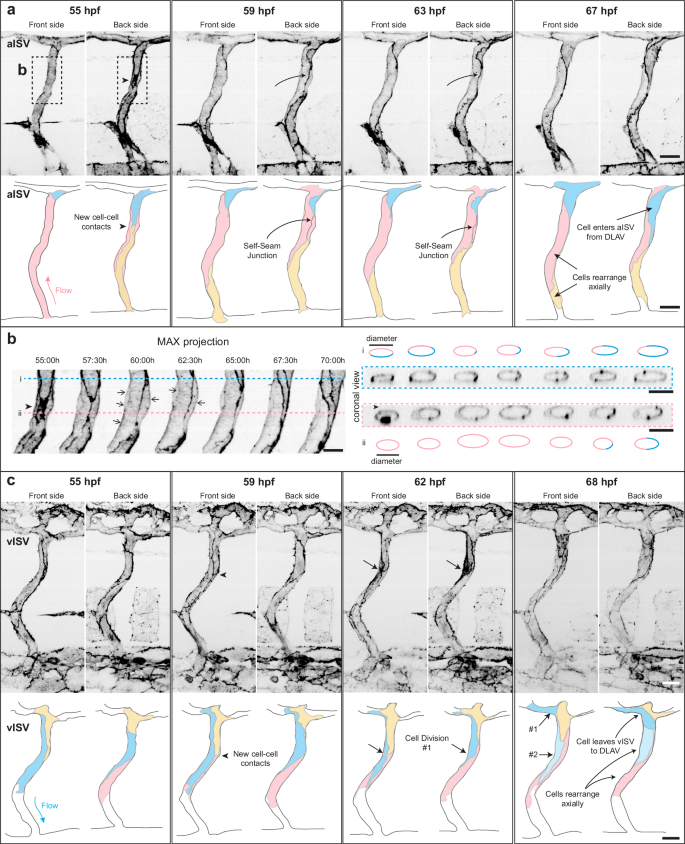 Fig. 3: Time-lapse imaging reveals distinct cell shape changes and rearrangement in aISVs and vISVs.