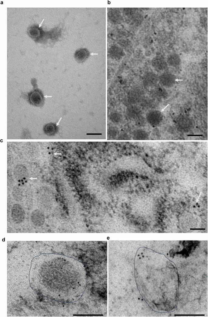 Fig. 6: Physical characterization of ngRNA formation in S. japonicum.