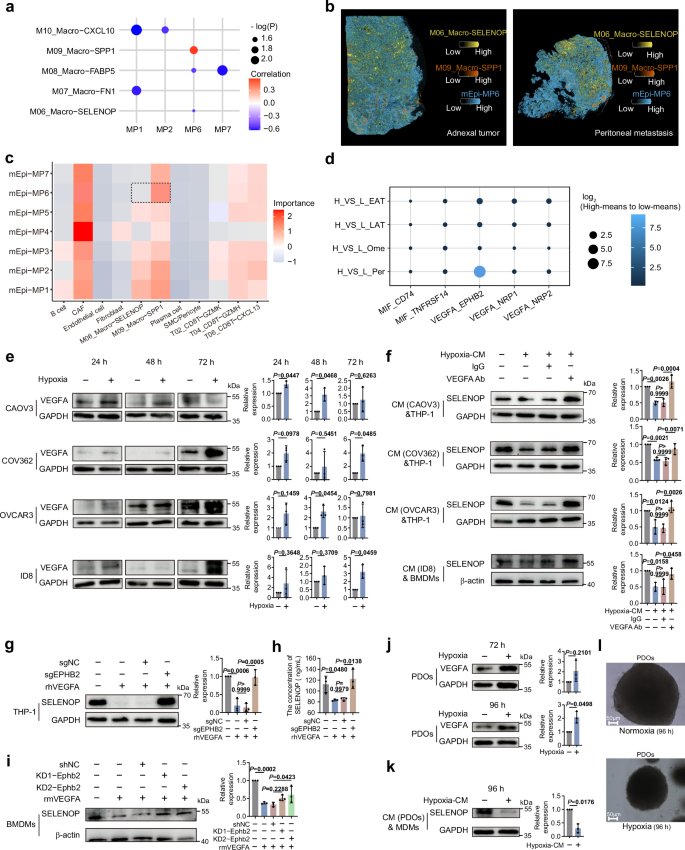 Fig. 6: Hypoxia-driven malignant epithelial cells of HGSOC reprogram SELENOP+ macrophages via VEGFA-EPHB2.