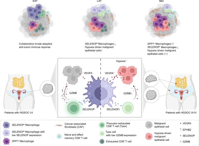 Fig. 8: Graphical summary of spatiotemporal heterogeneity in TME and model for the role of the malignant cells-macrophages-CD8+ T cells axis in immunosuppressive TME formation associated with HGSOC metastasis.