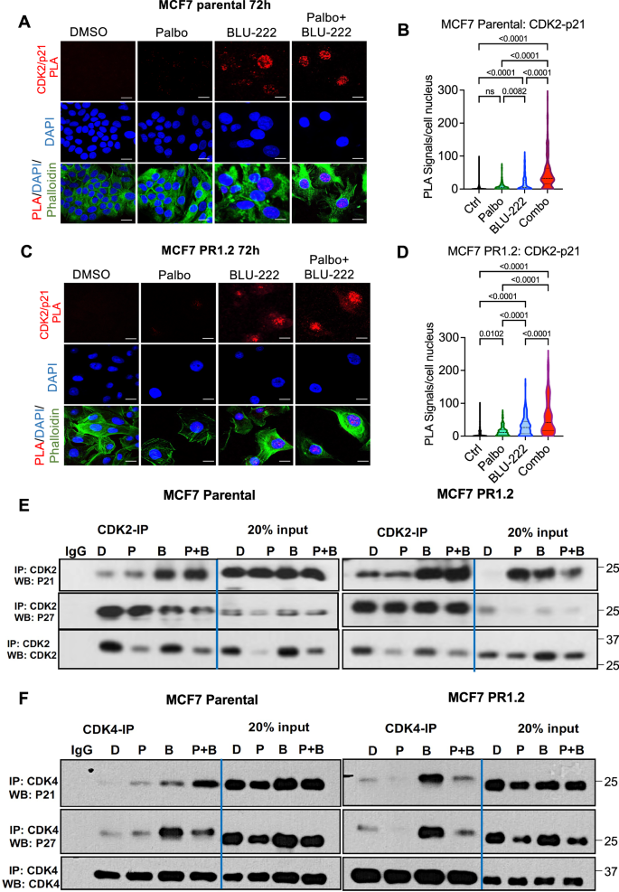 Fig. 4: Role of p21 and p27 in Mediating Synergistic Response to CDK4/6 Inhibitor and BLU-222 Combination Treatment.