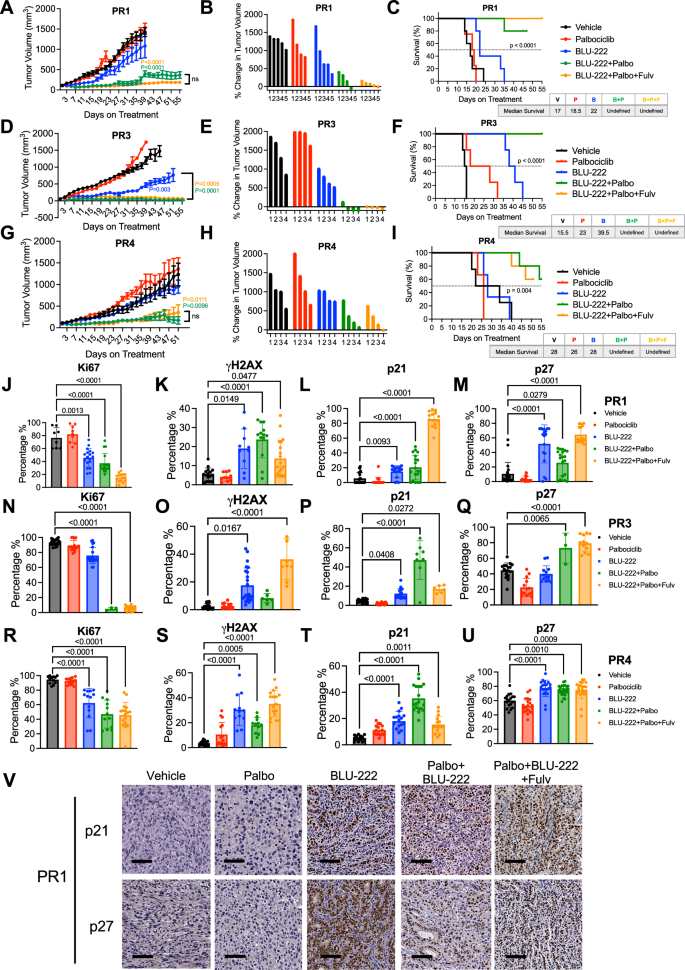 Fig. 5: Combination Treatment with BLU-222 and Palbociclib Synergistic in HR+/HER2− PDX Models That Progressed on Palbociclib Treatment.