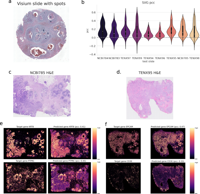Fig. 6: Comparison with Xenium measurements on Breast cancer.