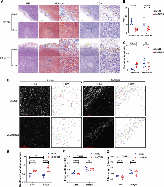 Fig. 3: GPR4 induced immune exclusion was related with remodeling ECM collagen.