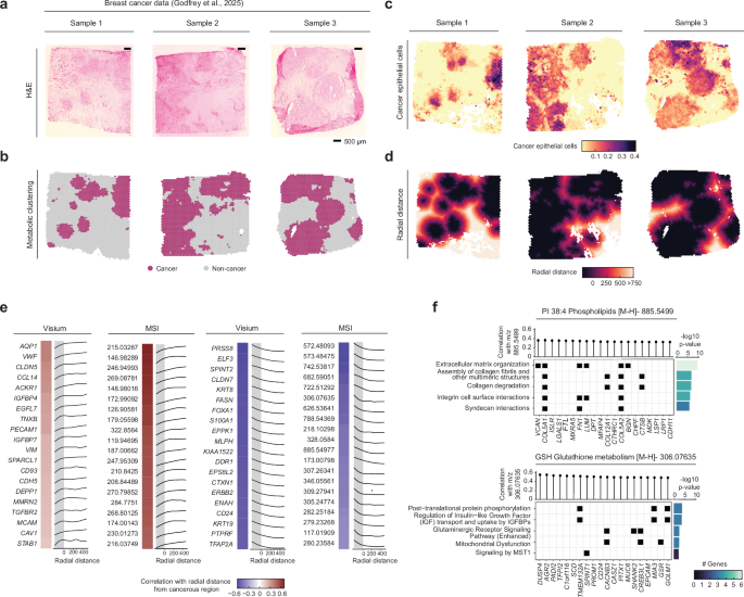 Fig. 5: Analysis of tumour microenvironment in human breast cancer through MAGPIE.