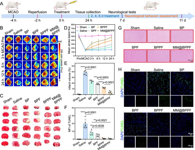 Fig. 7: In vivo therapeutic efficiency after different treatments in MCAO/R rat model.