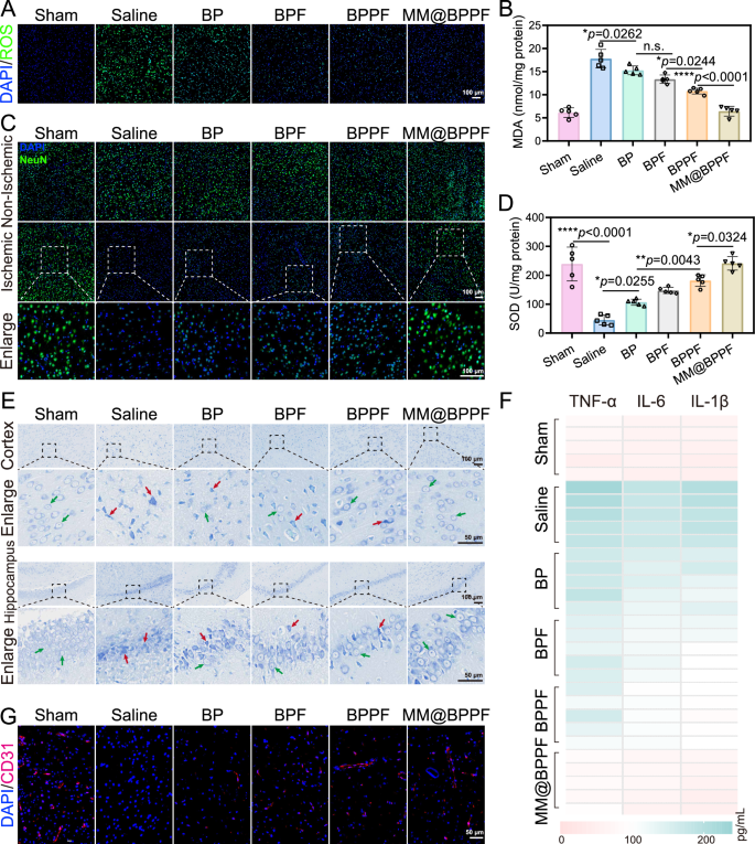 Fig. 8: In vivo neuroprotective effects after different treatments in MCAO/R rat model.