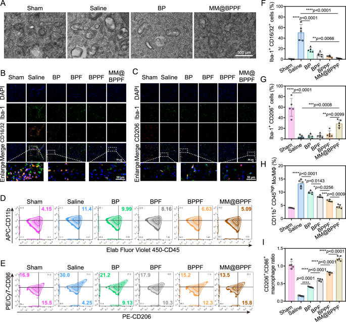 Fig. 9: In vivo evaluation of neuroprotective mechanisms of MCAO/R rats after different treatments.
