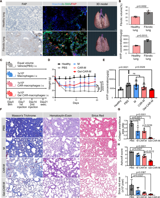 Fig. 4: Hydrogel priming improved the therapeutic effect of CAR-M on murine pulmonary fibrosis model.