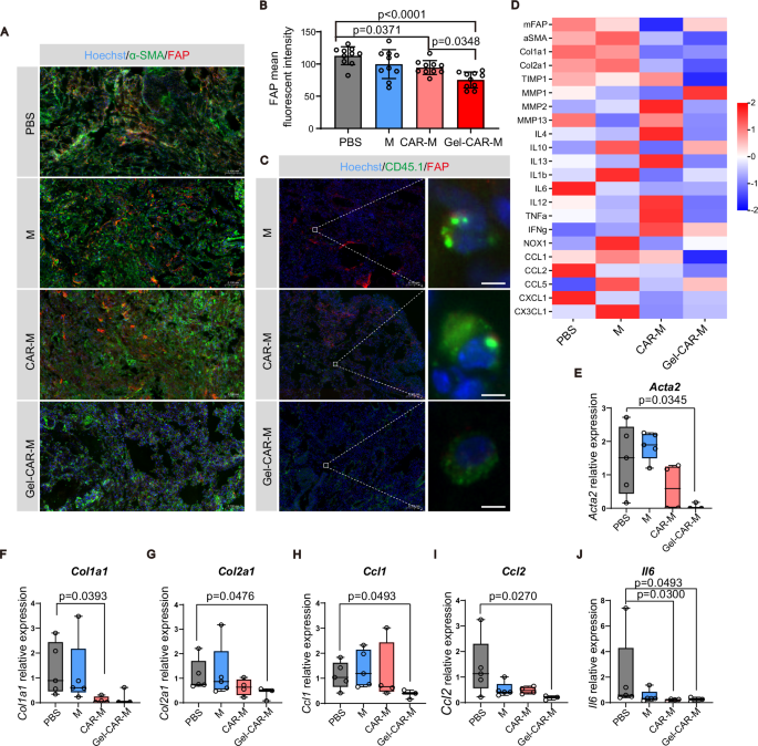 Fig. 5: Gel-CAR-Ms exhibited advanced efficacy in eradicating FAP-positive cells and restoring the immune microenvironment in fibrotic lungs.