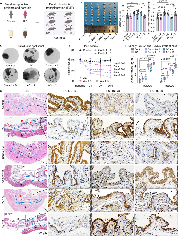 Fig. 5: HIC-derived fecal microbiota alters host metabolism and increases bladder vulnerability.