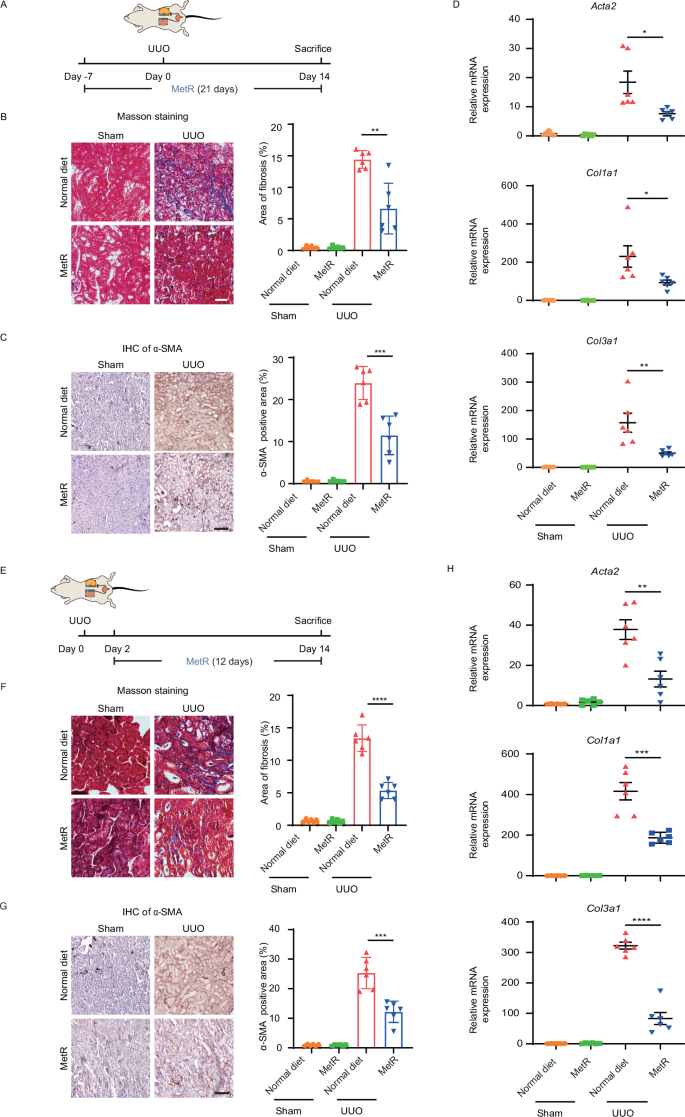 Fig. 2: MetR reduces kidney fibrosis in UUO mice.