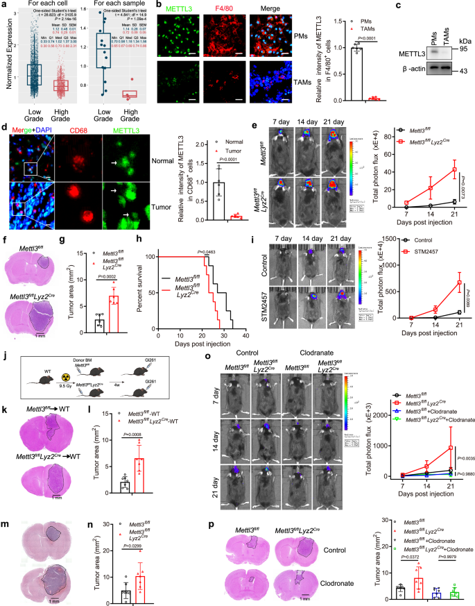 Fig. 1: Lower expression of METTL3 in tumor-associated macrophages in GBM.