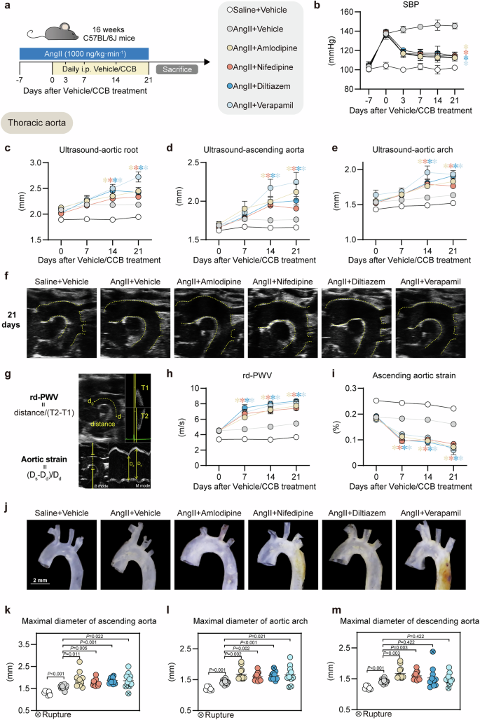 Fig. 2: CCBs (amlodipine, nifedipine, diltiazem, verapamil) aggravated thoracic aortic diameters in Ang II-induced aortic aneurysm mouse model.