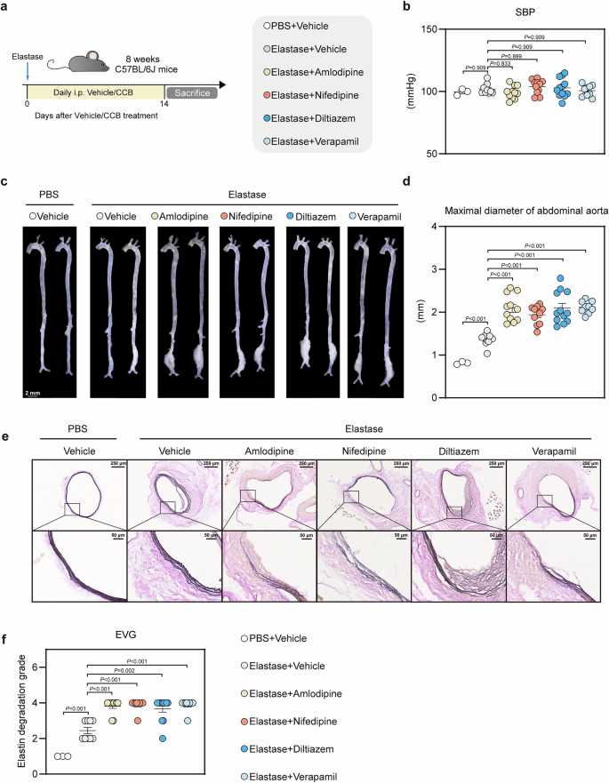 Fig. 4: CCBs (amlodipine, nifedipine, diltiazem, verapamil) exacerbated elastase-induced AAA and elastin degradation in mice.