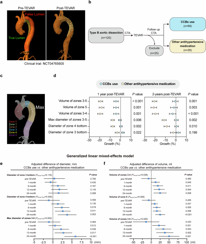 Fig. 6: The application of CCBs limited aortic regression in patients with Type B Aortic Dissection Patients following endovascular therapy.