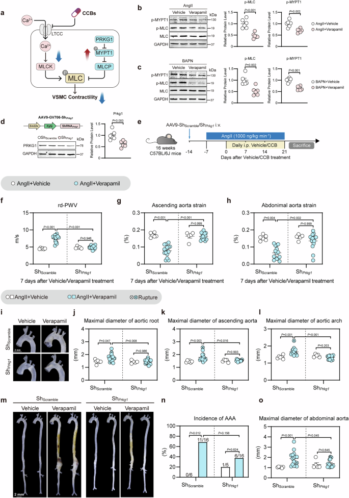 Fig. 7: Silencing of Prkg1 mitigates CCB-aggravated AAD in mice.