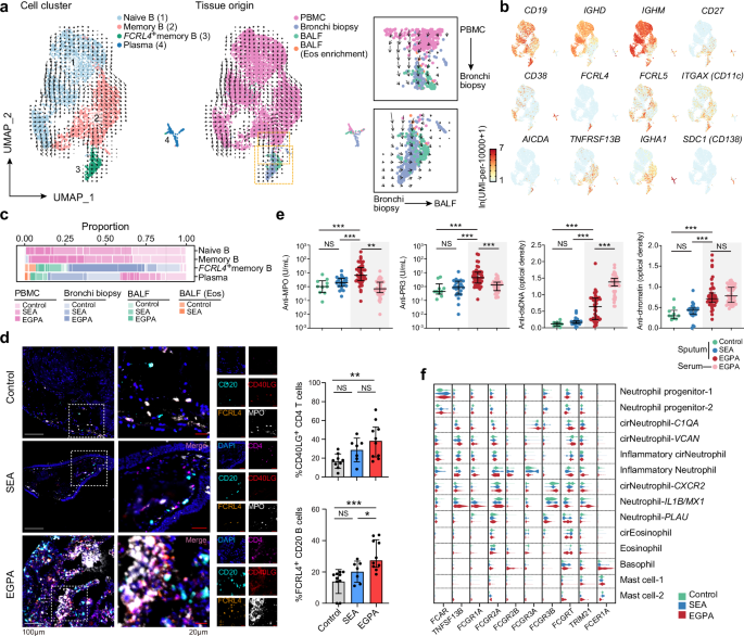 Fig. 3: TLS encompassing FCRL4+CD11C+ B cells, neutrophils and T cells are enriched in EGPA.