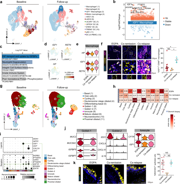 Fig. 4: Treatment refractory EGPA exhibit increased IGF1⁺ macrophages, goblet hyperplasia and mucin production.
