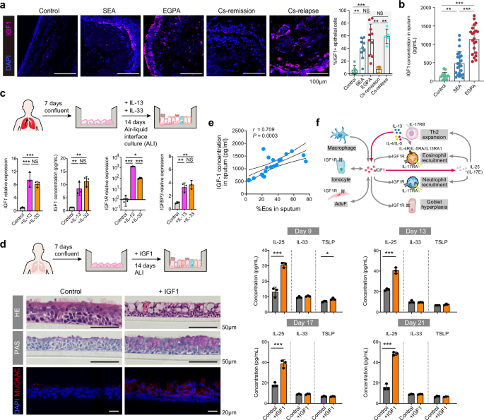 Fig. 5: IGF1-IL25 axis promotes goblet hyperplasia and augments T2-mediated inflammation.
