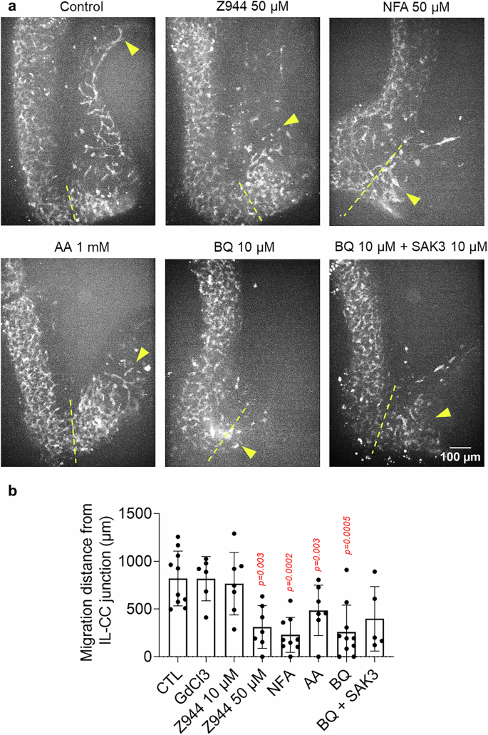 Fig. 5: Inhibition of Ca2+ activity slows down ENCC migration in the cecum and colon.