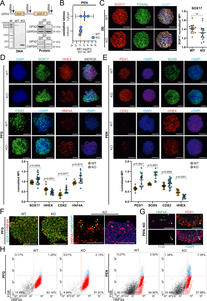 Fig. 2: GPX2 deficiency results in altered differentiation of the posterior foregut endoderm.