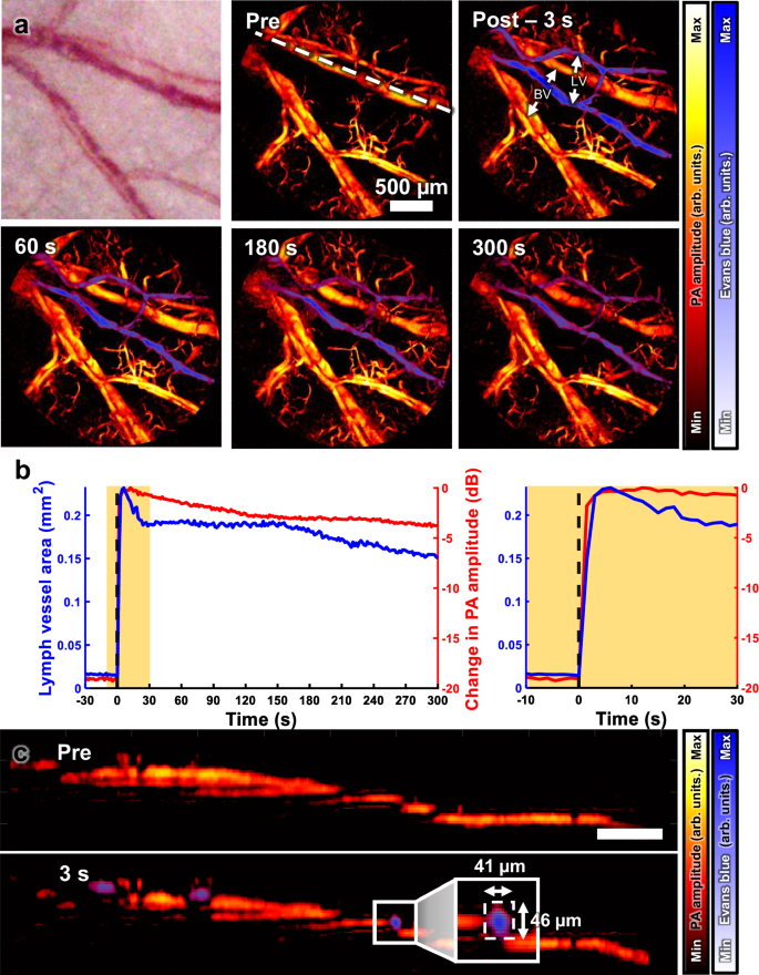 Fig. 6: PA imaging of lymphatic vessels in a mouse ear with Evans blue injection.