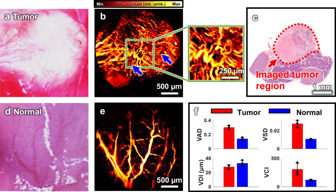 Fig. 7: PA imaging of a metastatic tumor in a mouse’s abdomen.