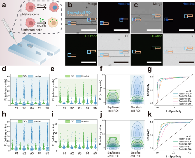 Fig. 4: On-chip screening for infected MDA-MB-231 cells after bacteria were labeled with DiO.