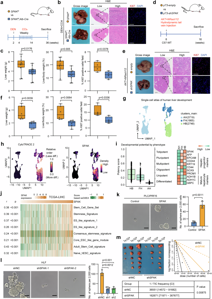 Fig. 2: SPAK promotes tumorigenesis and stem cell properties of HCC.