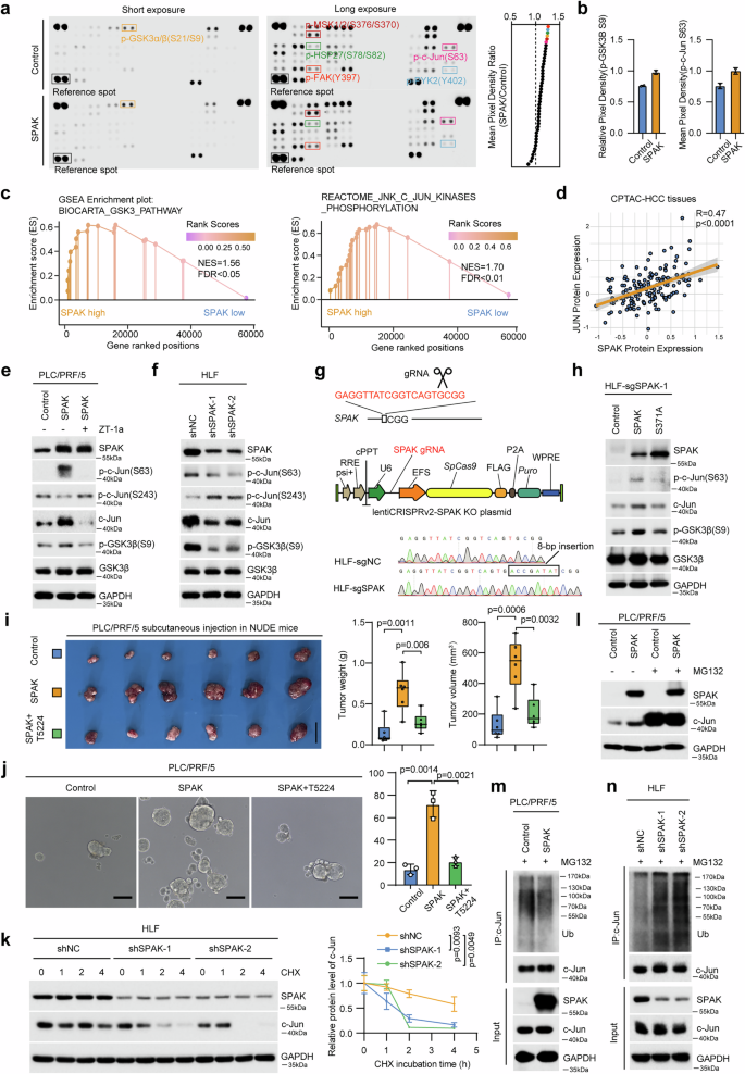 Fig. 4: SPAK deactivates GSK3β and stabilizes c-Jun to facilitate HCC progression and resistance to multikinase inhibitors.