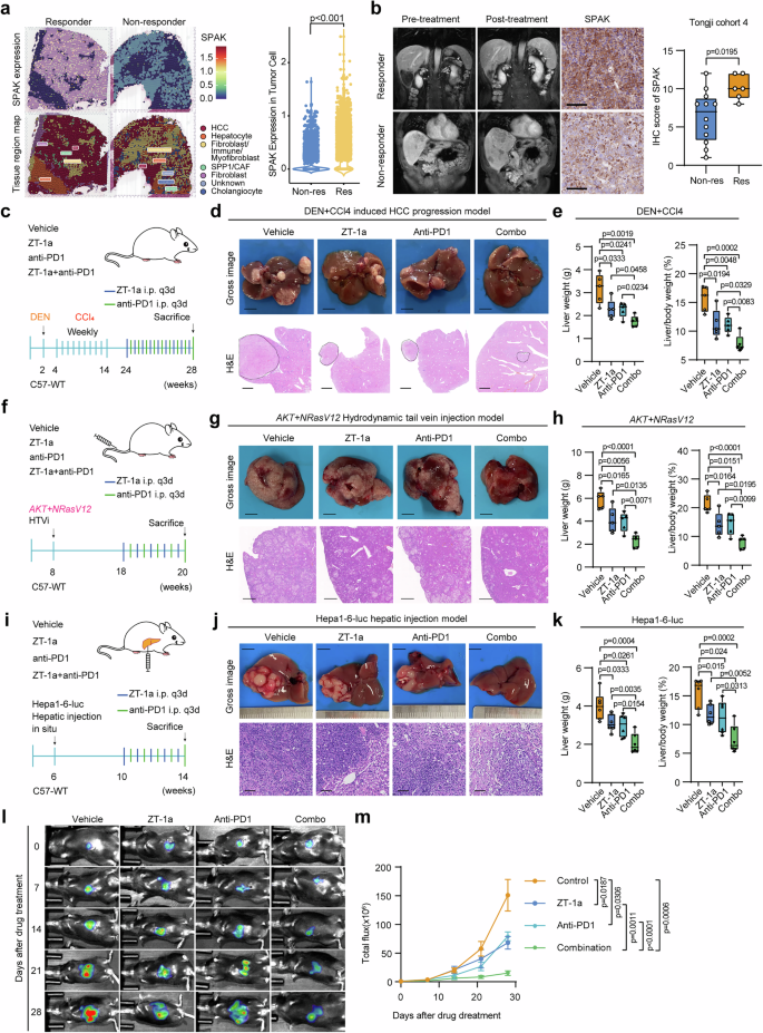 Fig. 8: Combined targeting SPAK and PD-1 showed enhanced efficacy in HCC.