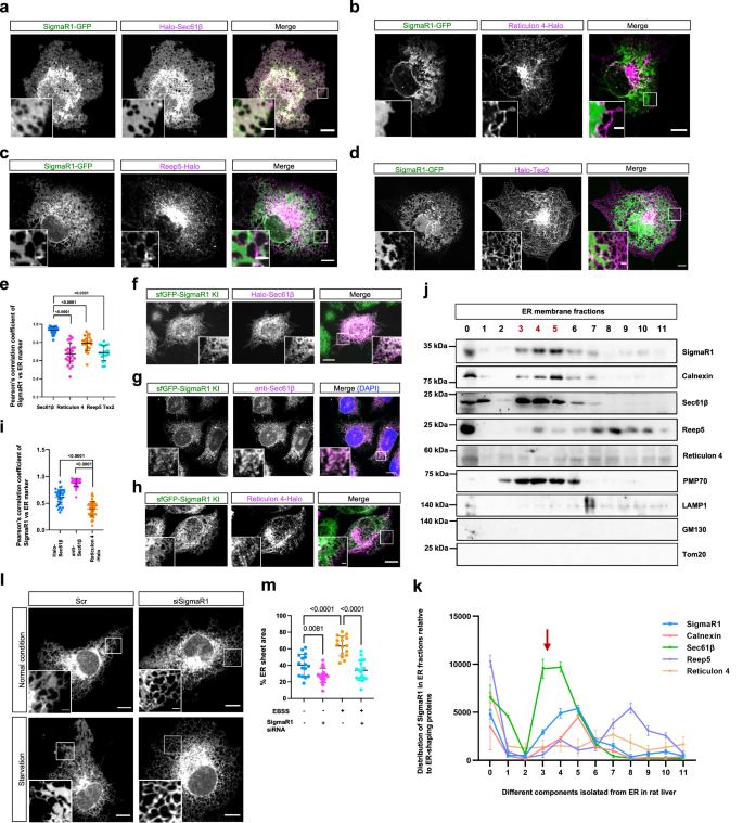 Fig. 1: SigmaR1 is an ER sheet protein.