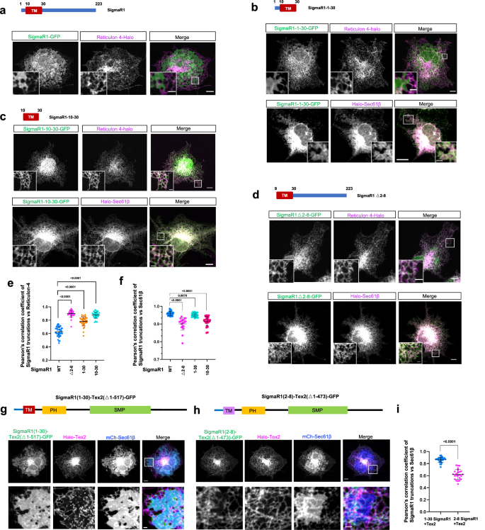 Fig. 2: A short region in N-terminus promotes SigmaR1 targeting to ER sheet.
