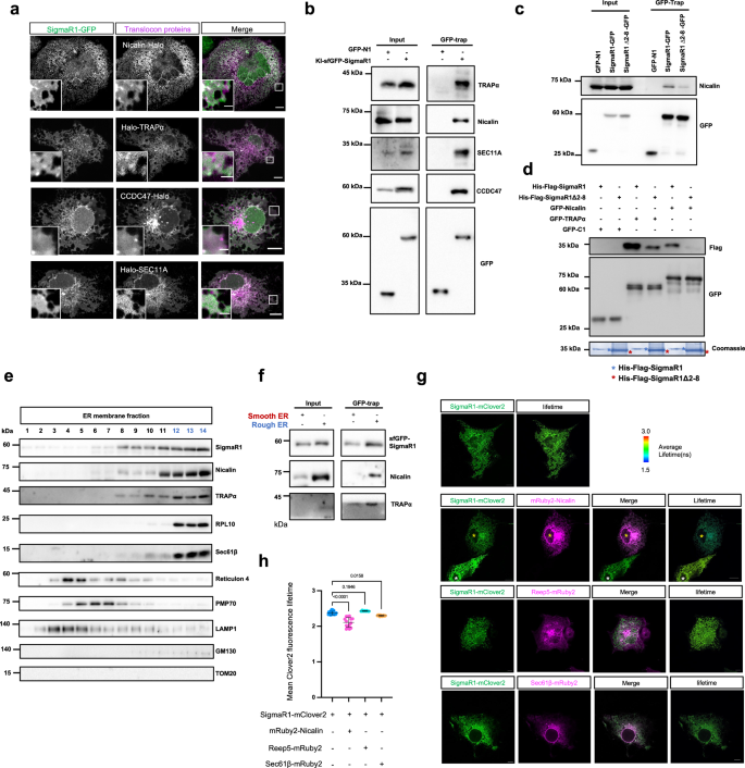 Fig. 3: SigmaR1 interacts with the translocon complex on the ER.