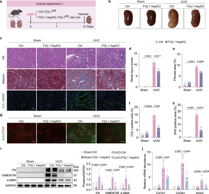 Fig. 2: Hepatocyte-specific deletion of FGL1 alleviates UUO-induced renal fibrosis in mice.