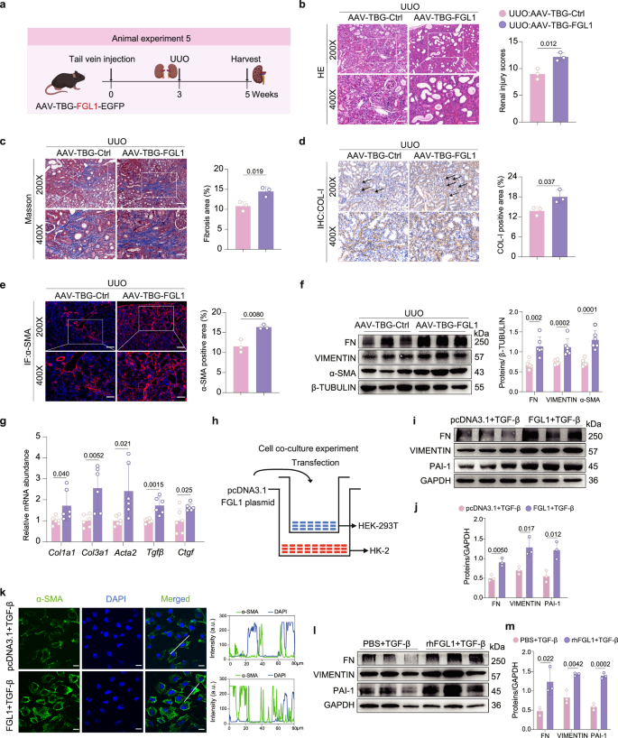 Fig. 3: Hepatocyte-specific FGL1 overexpression aggravates UUO-induced renal fibrosis in mice.