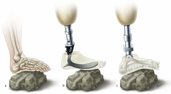 Fig. 1: Biological and artificial feet.