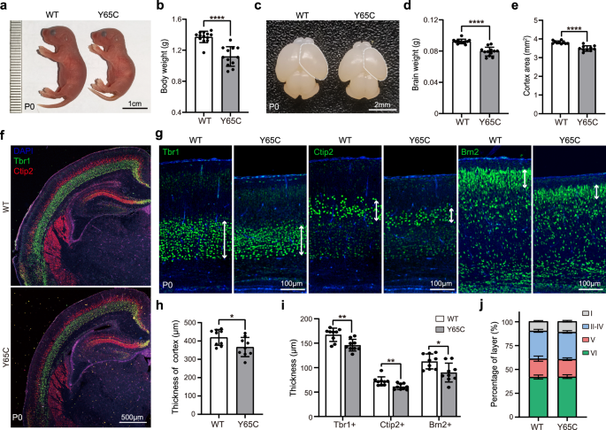 Fig. 1: Pqbp1Y65C/Y mice exhibit short stature, and microcephaly.