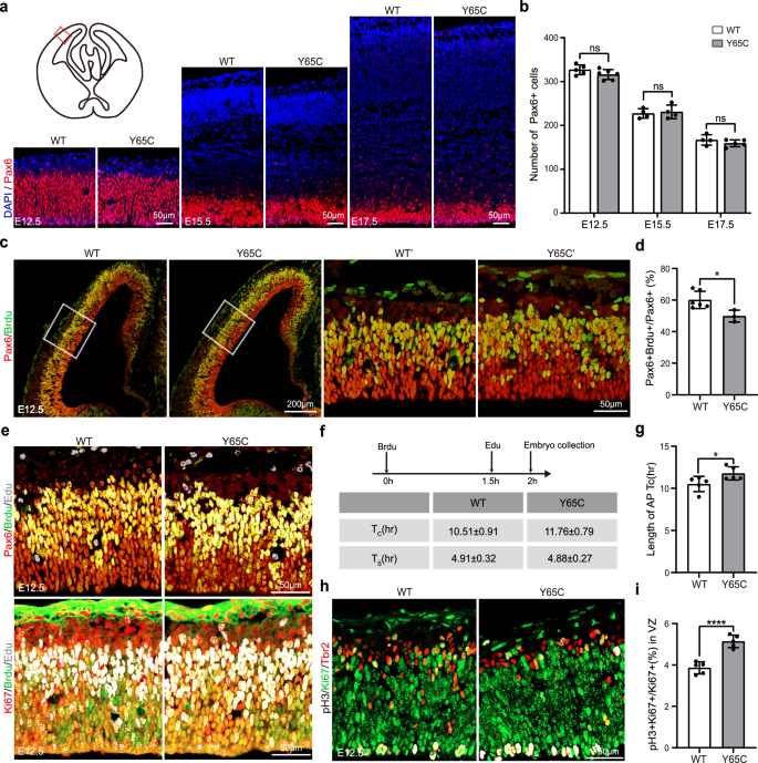 Fig. 2: Impaired proliferation of APs in Pqbp1Y65C/Y mice.