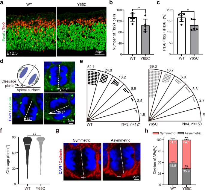 Fig. 3: Impaired differentiation of APs in Pqbp1Y65C/Y mice.