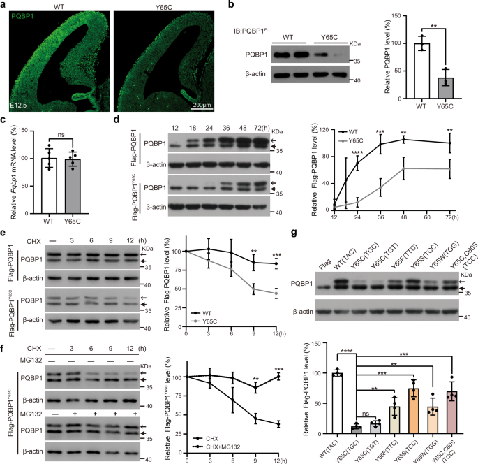 Fig. 4: The Y65C mutation significantly reduces PQBP1 protein levels.
