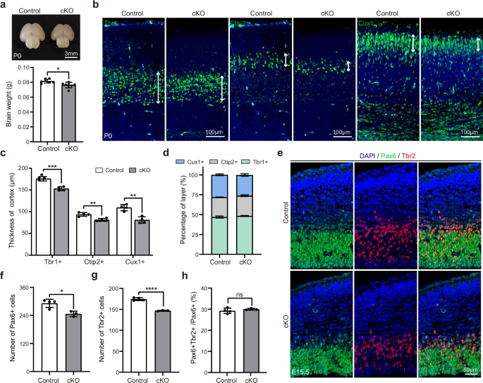 Fig. 5: Nestin-cKO mice display microcephaly without deficits in the AP-to-BP transition.