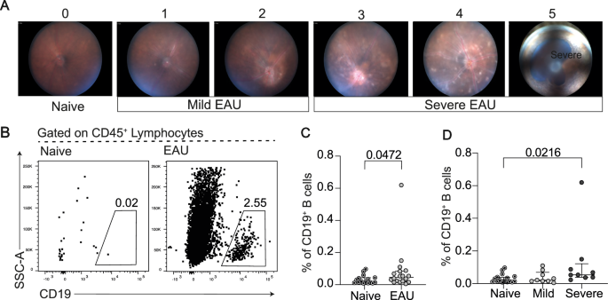 Fig. 6: B cells infiltrate the retinas of mice, specifically in those with severe uveitis.