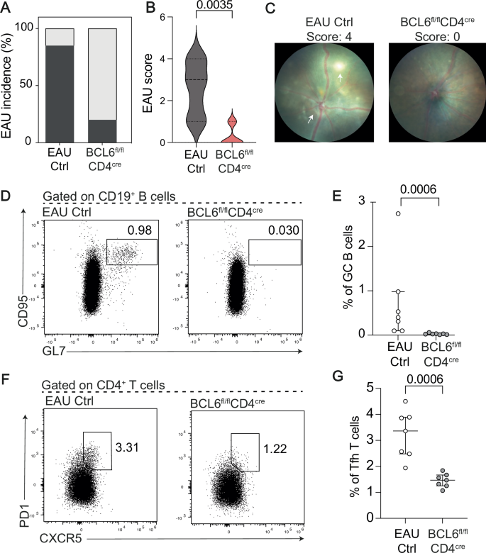 Fig. 8: Mice who are deficient in T follicular helper cells have significantly reduced uveitis severity.
