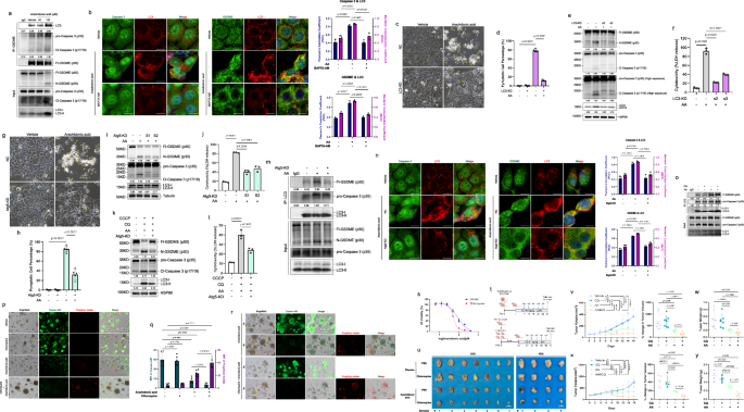 Fig. 6: Autophagosome formation provides a scaffold for GSDME activation and promotes arachidonic acid induced pyroptosis.